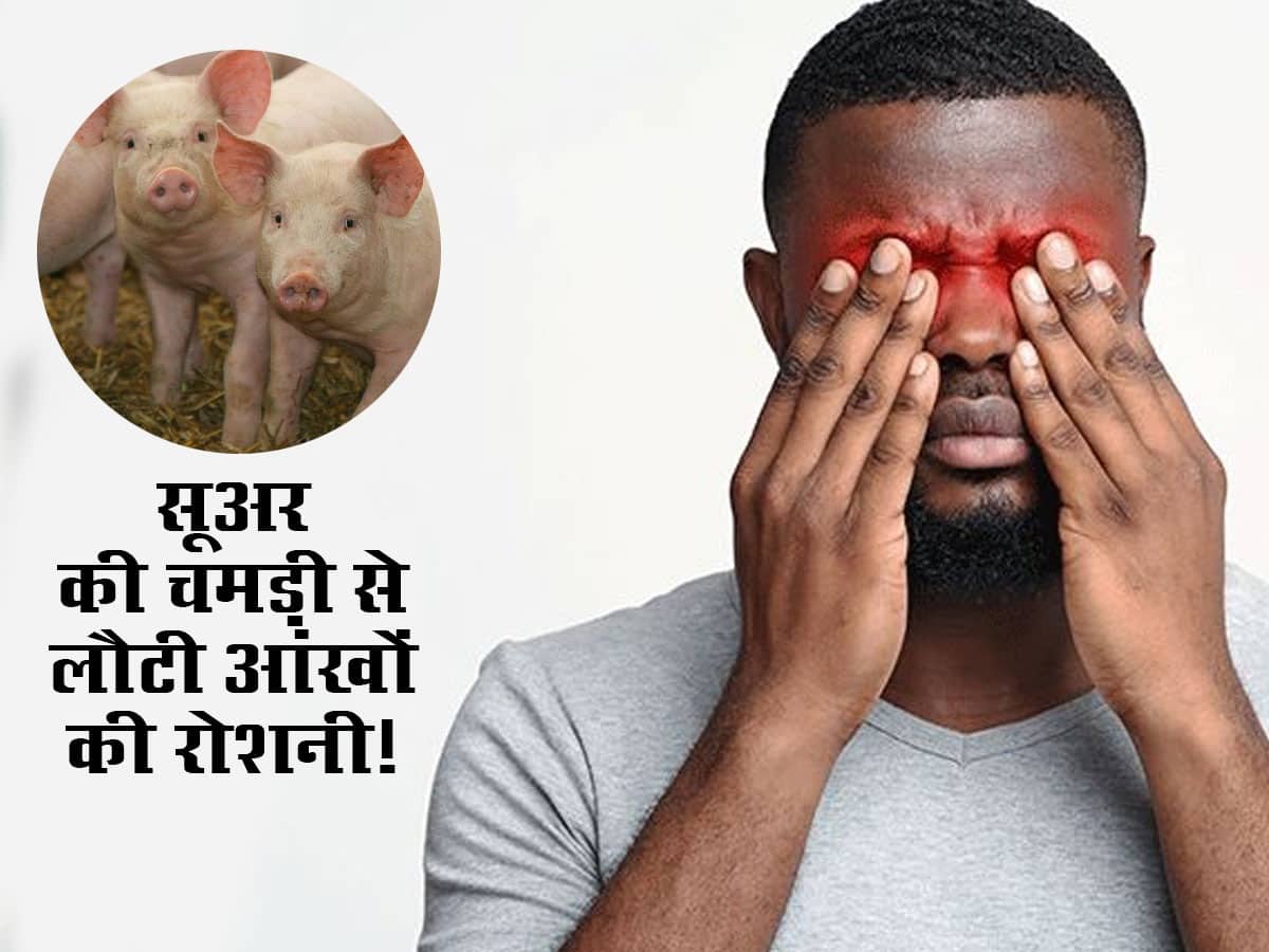 सूअर की चमड़ी ट्रांसप्लांट करने से 19 अंधे लोगों की आंखों की रोशनी लौटी! जानें कैसे हुआ चमत्कार
